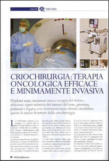 CRIOCHIRURGIA: TERAPIA ONCOLOGICA EFFICACE E MINIMAMENTE INVASIVA